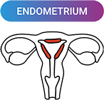endometrium_up